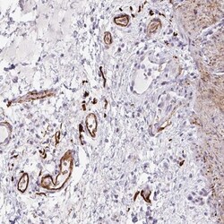 TEM Antibody, Novus Biologicals 0.1mL; Unlabeled:Antibodies, Polyclonal